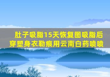肚子吸脂15天恢复图吸脂后穿塑身衣勒痕用云南白药喷喷